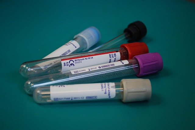 Badanie laboratoryjne krwi